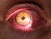 Fig. 1A