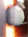 Fig. 1B