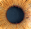 Fig. 2B
