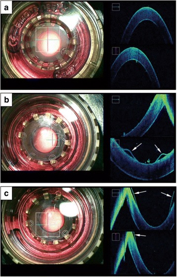 Fig. 3