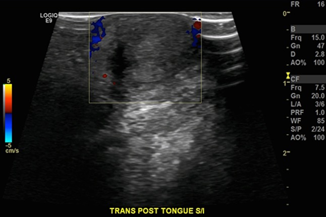 Fig. 1