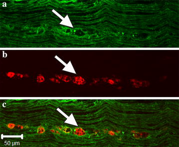 Fig. 4