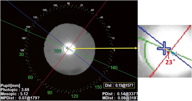 Fig. 1