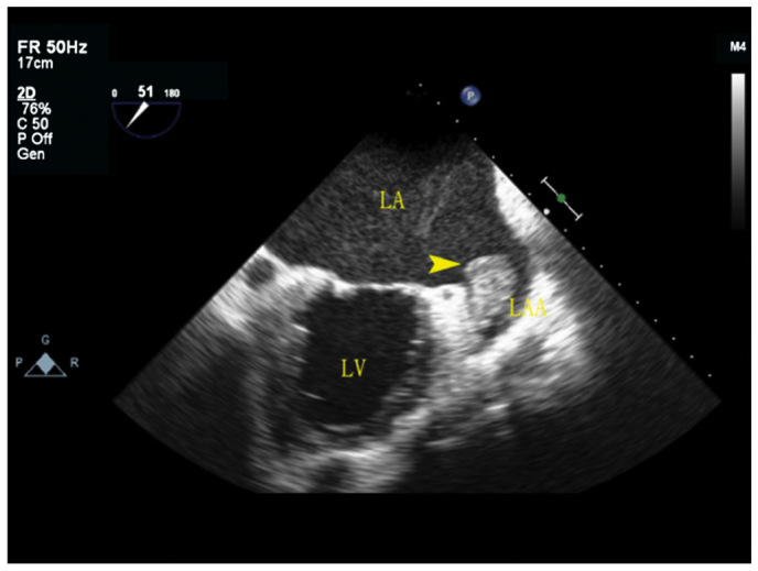 Figure 2.