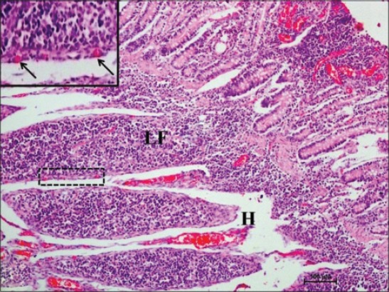 Figure-5