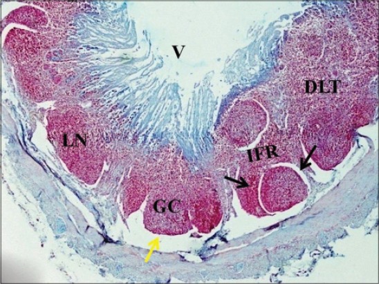 Figure-12