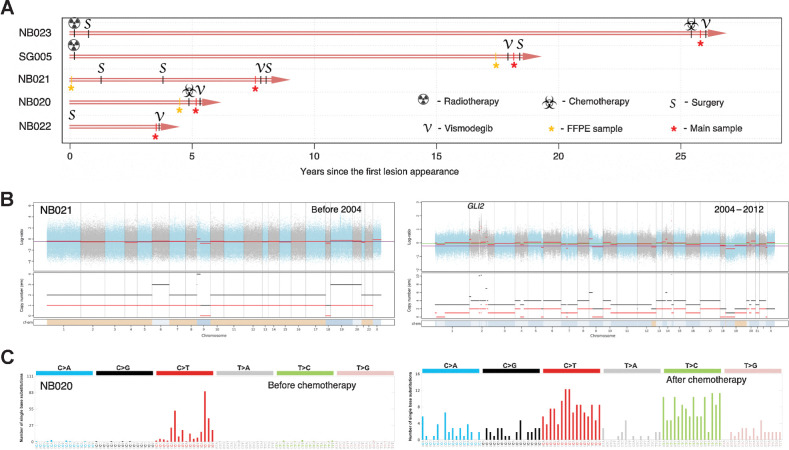 Figure 3. IR-BCC tumor evolution and associated genomic changes. A, Time course of the studied IR-BCC samples since the first diagnosis or lesion appearance. B, Copy-number profile of the two tumor samples of patient NB021: from 2004 (initial BCC; left) and 2012 (IR-BCC; right). Log ratio indicates difference in normalized coverage between normal and tumor samples. Copy number depicted for the total number of DNA copies (black) and minor allele (red). C, Trinucleotide-context mutational profiles of the two tumor samples of patient NB020: before (left) and after (right) chemotherapeutic treatment with cisplatin and adriamycin.