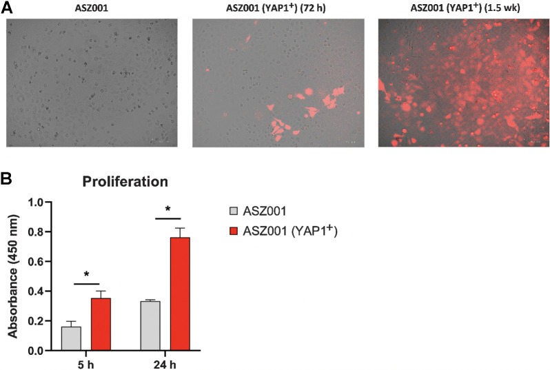 Figure 5. Proliferation for ASZ001 Yap1-overexpressing and ASZ001 cell lines for two time intervals (5 and 24 hours). A, ASZ001 cell line in culture (control; left); YAP1-transfected ASZ001 72 hours after transfection (mCherry positivity indicates successful transfection; middle); YAP1-transfected ASZ001 1.5 weeks after transfection and after puromycin treatment for selection of transfected cells (mCherry positivity indicates successful transfection; right). B, Proliferation assay for ASZ001 and ASZ001 YAP1-overexpressing cell lines after 5 and 24 hours of culturing time.