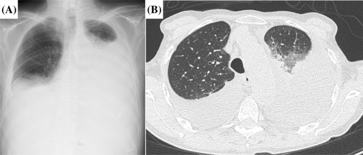 FIGURE 1