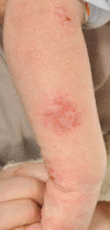 Fig 1.