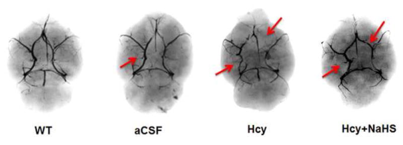 Fig. 13