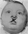 183