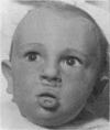 187