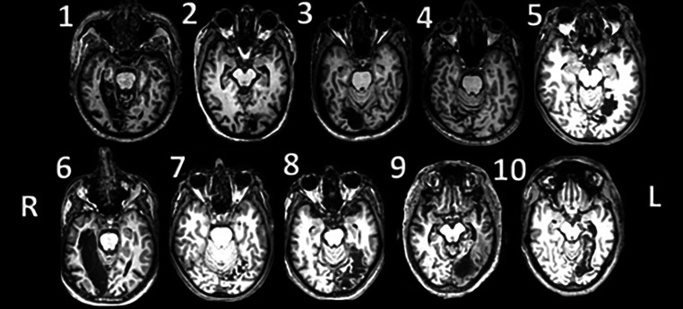 Fig. 2