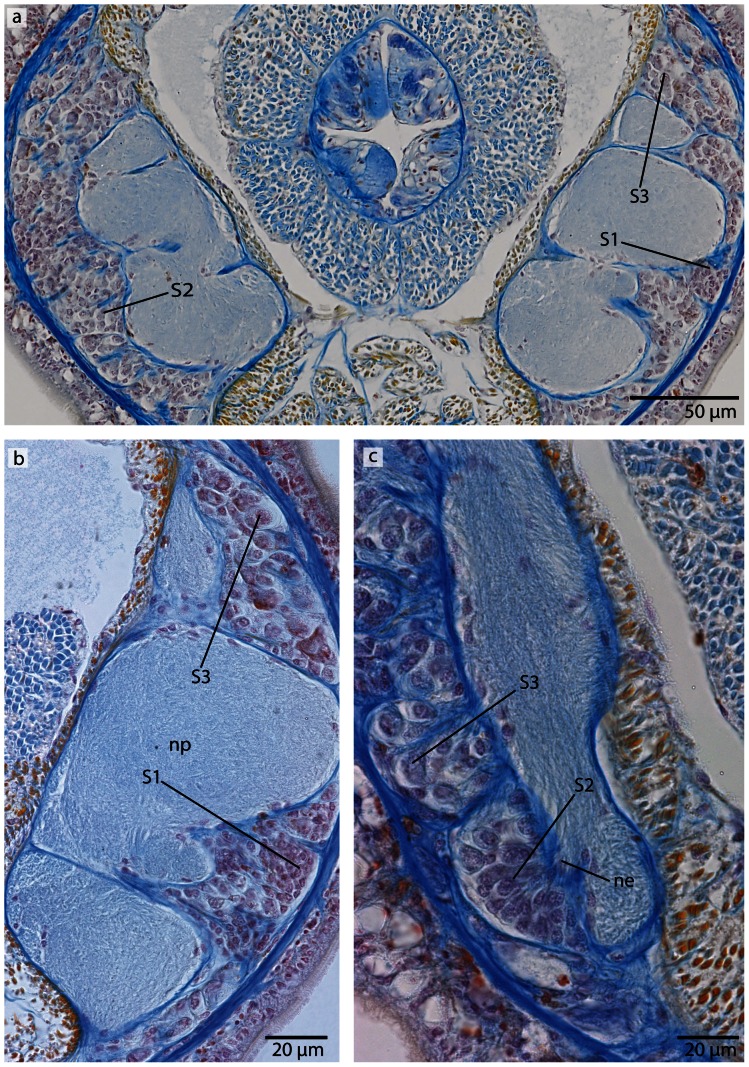 Figure 23