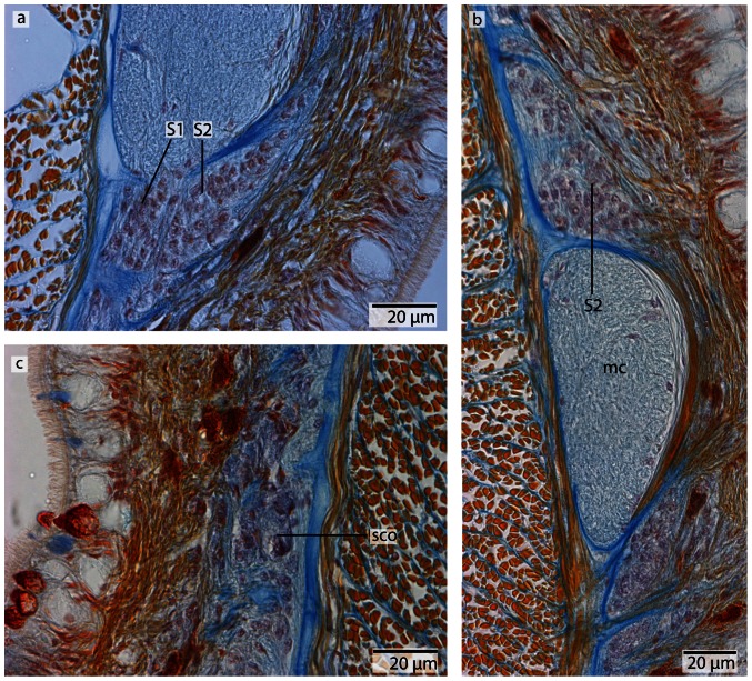 Figure 26