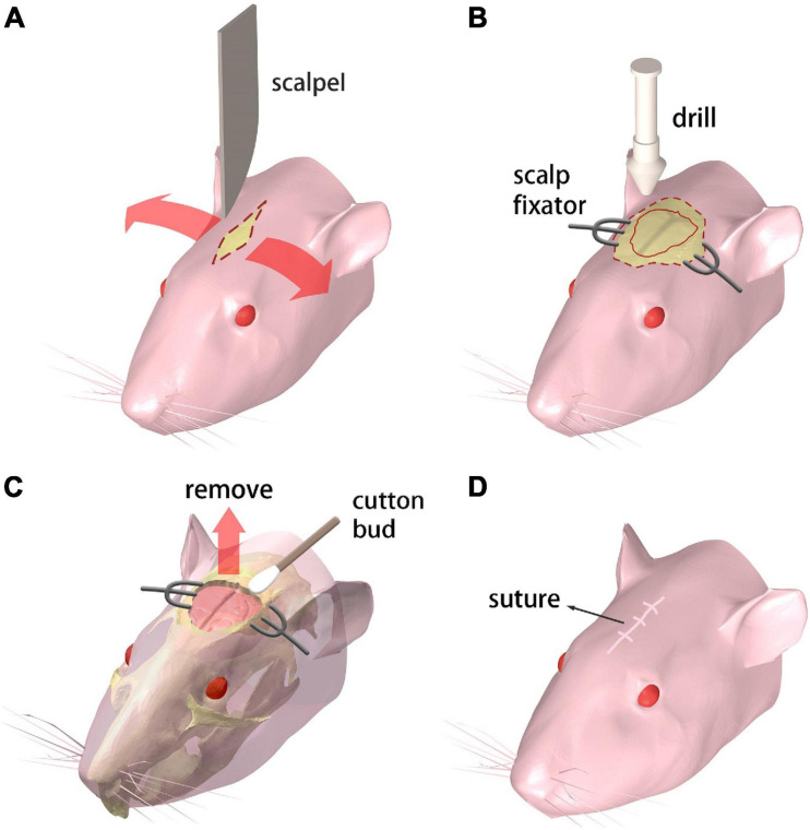 FIGURE 1