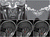 FIG. 1.