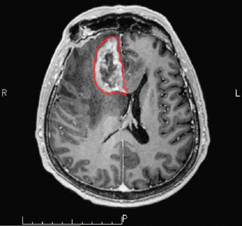 Figure 3 a-b