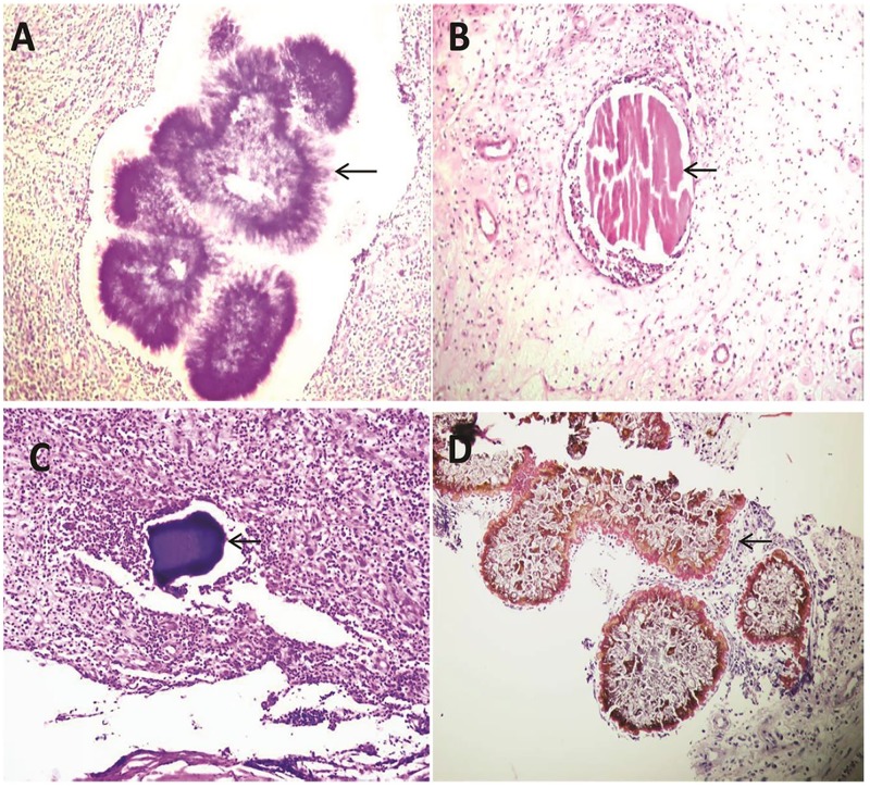 Fig 3