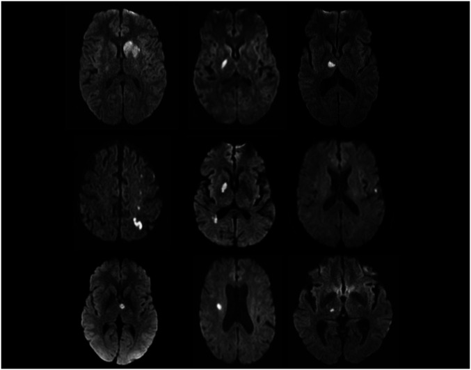 Fig. 2.