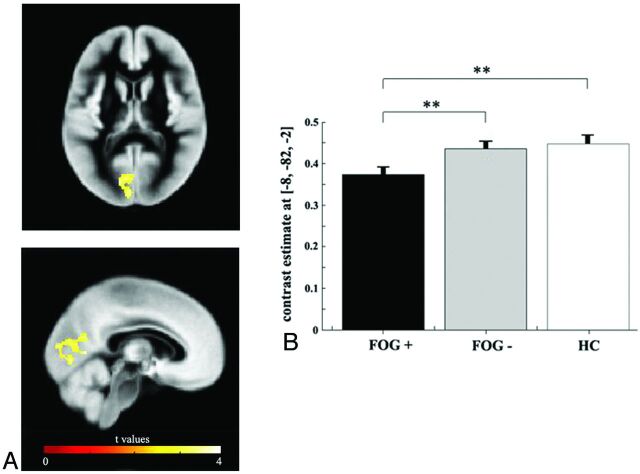 Fig 1.