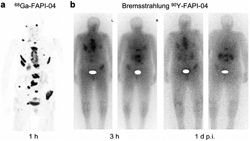 Fig. 10