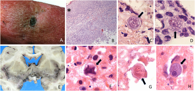 FIG 2