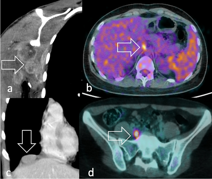 Figure 15.