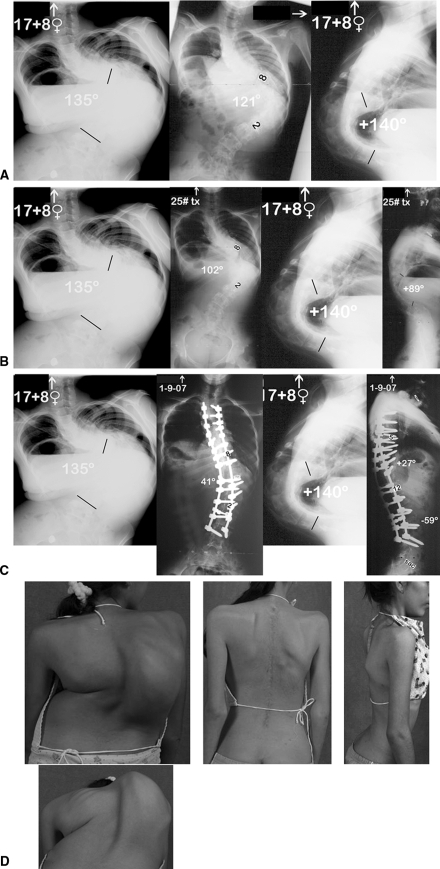 Fig. 1A–D