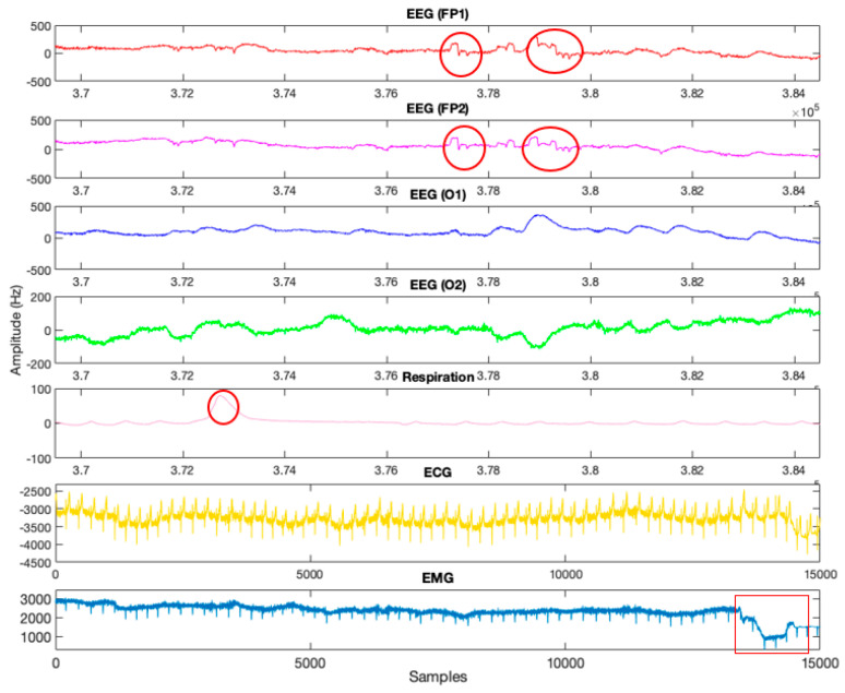 Figure 16