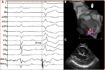 Figure 2: