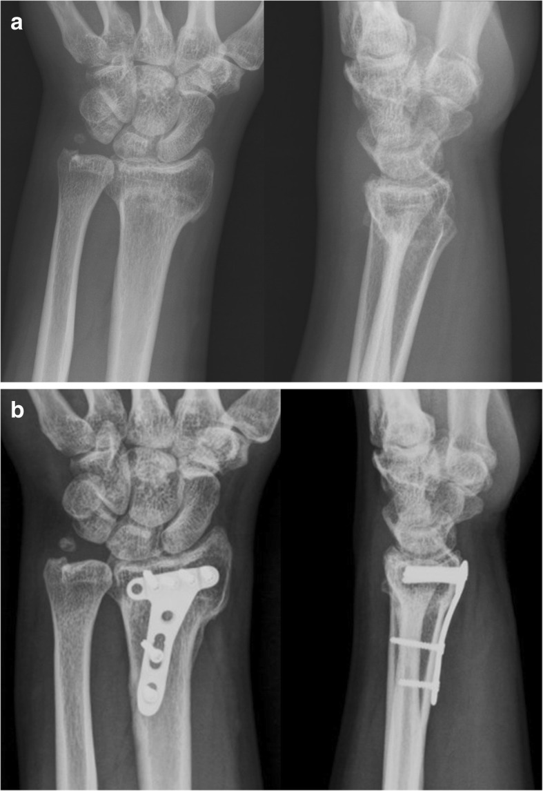 Fig. 2