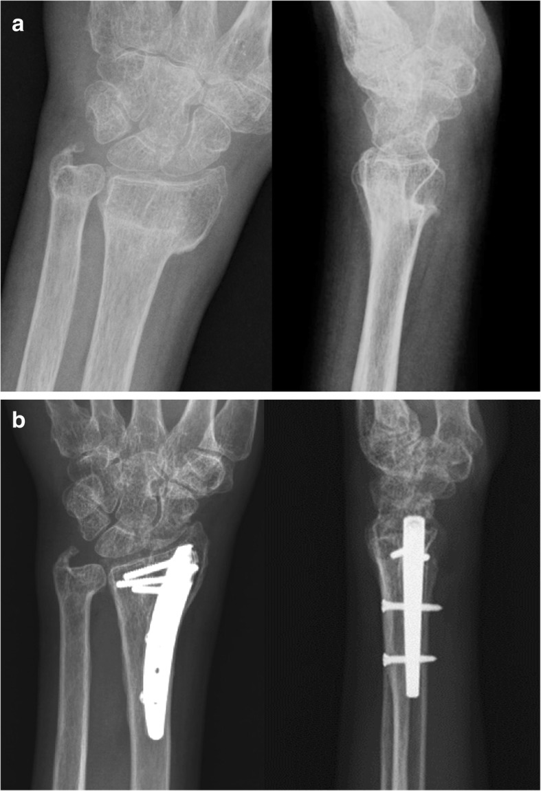 Fig. 1