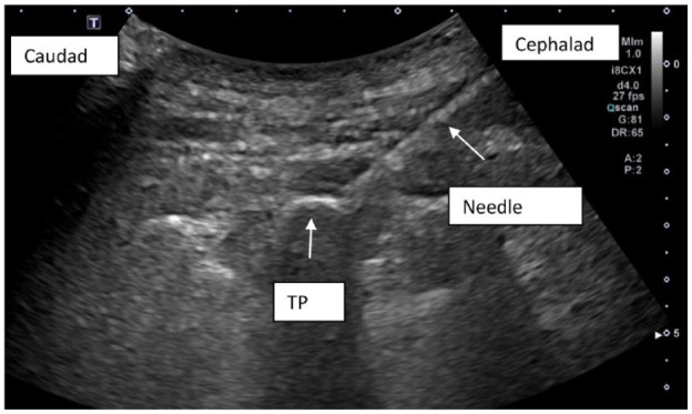 Figure 2.