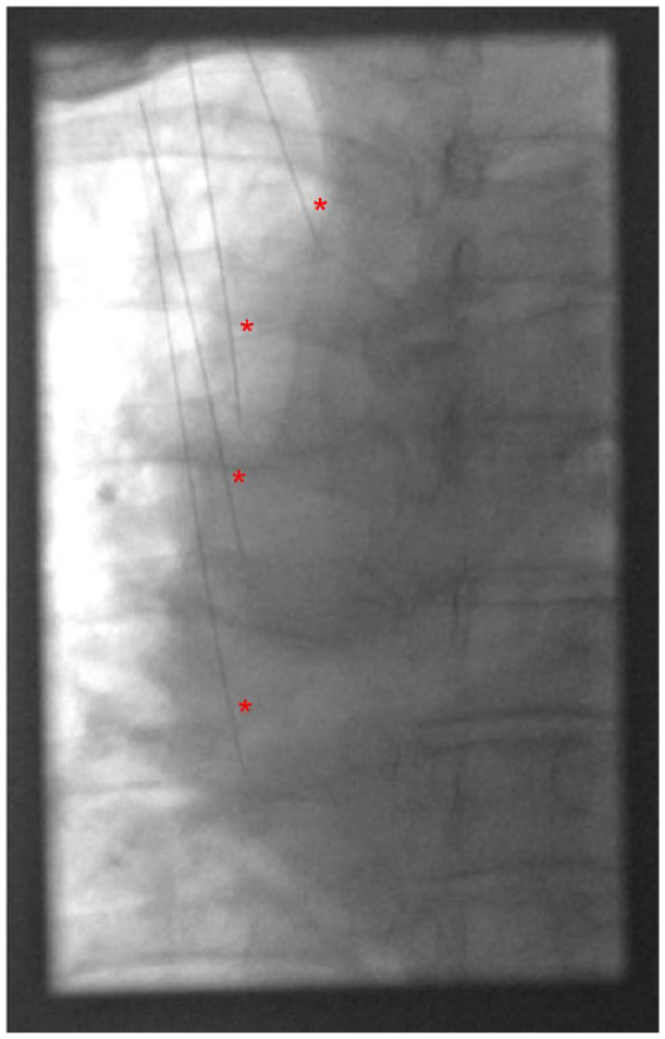 Figure 3.