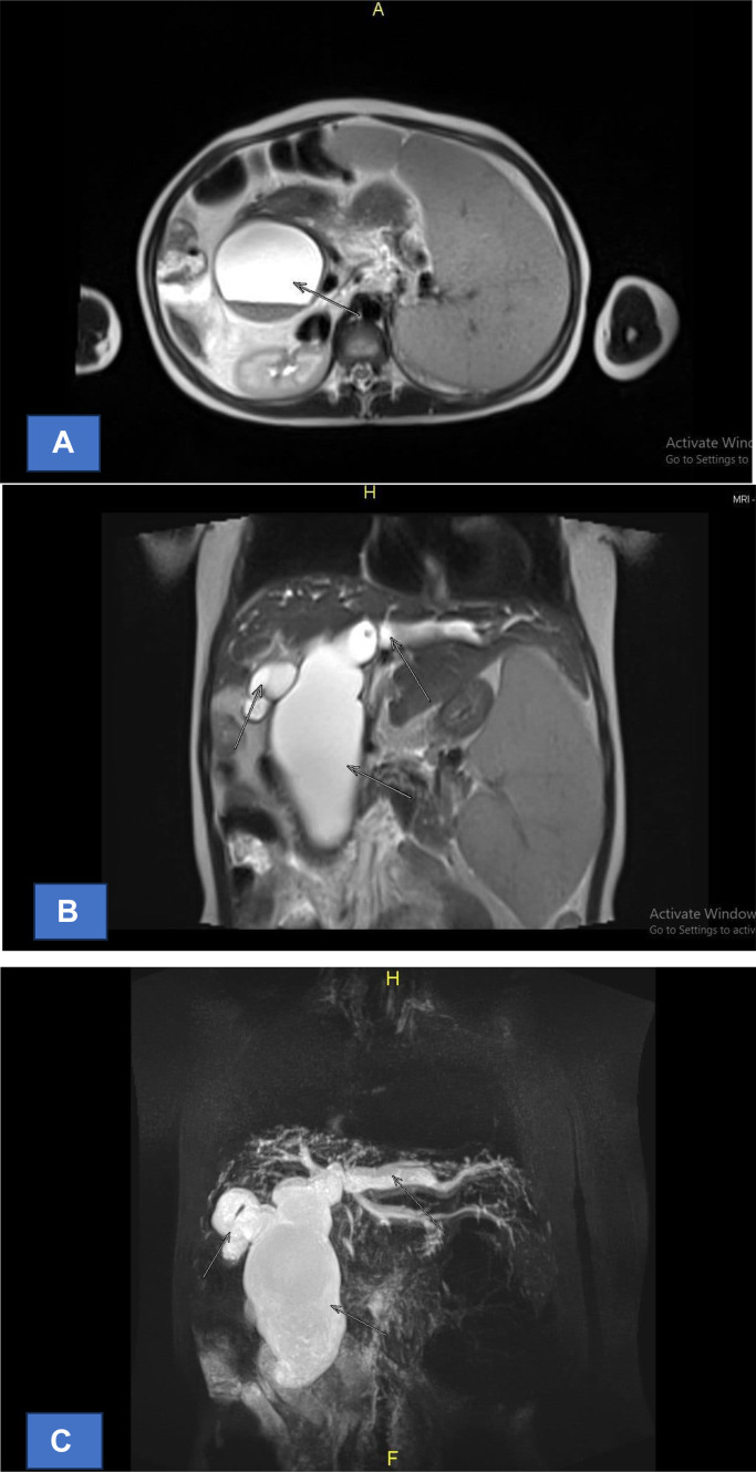 Fig 4