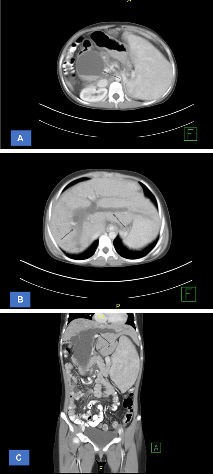 Fig 3