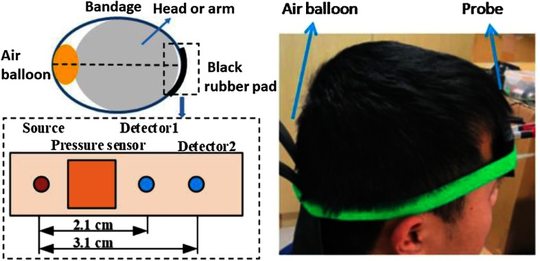 Fig. 2