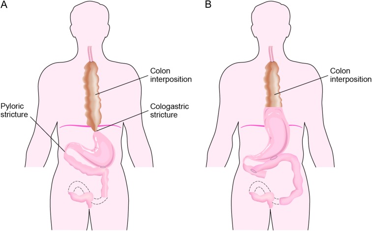 Figure 2: