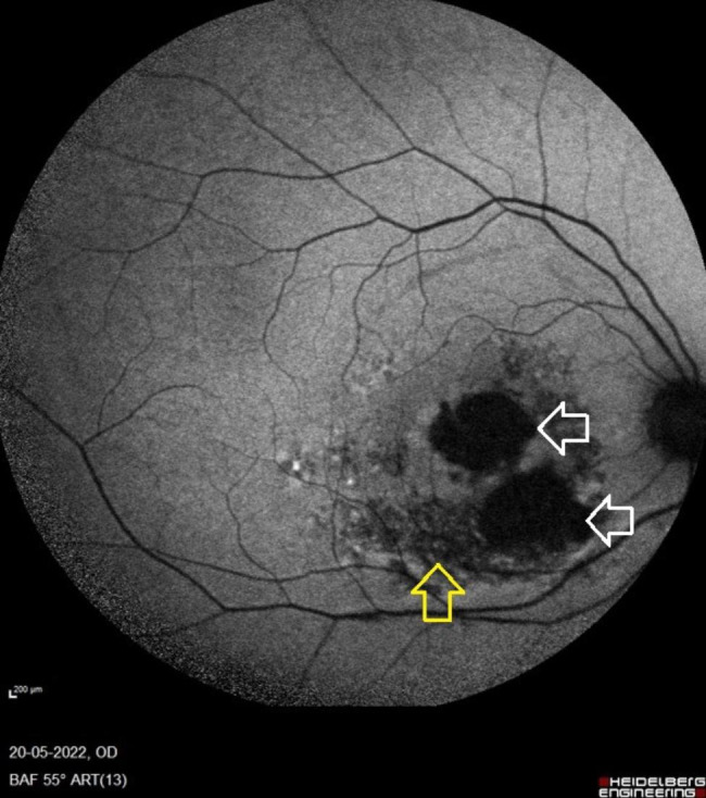 Fig. 2