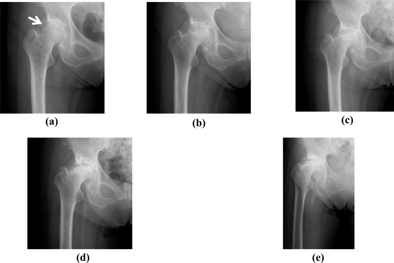 Fig. (1)