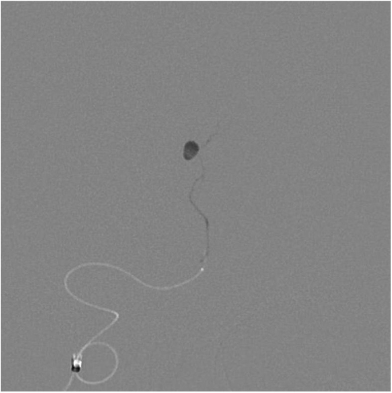 Fig. 5