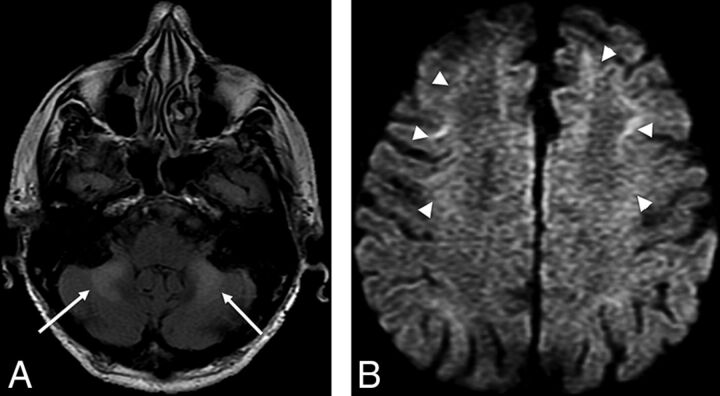 Fig 2.