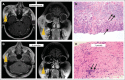 Fig 3.