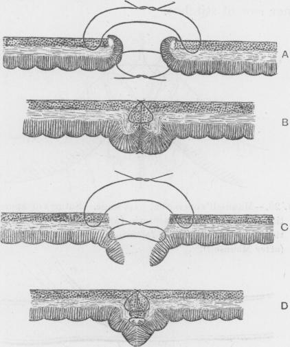 Fig. 25