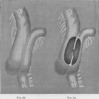 Figs. 23-24