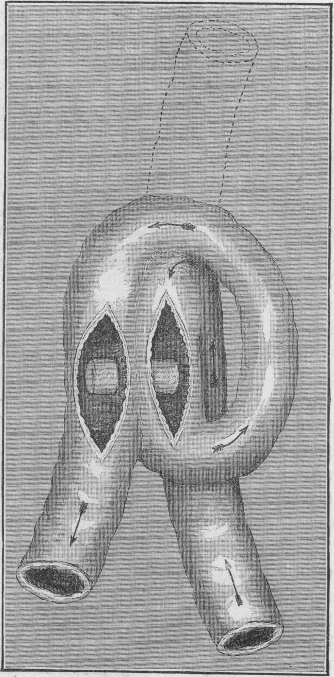 Fig. 45