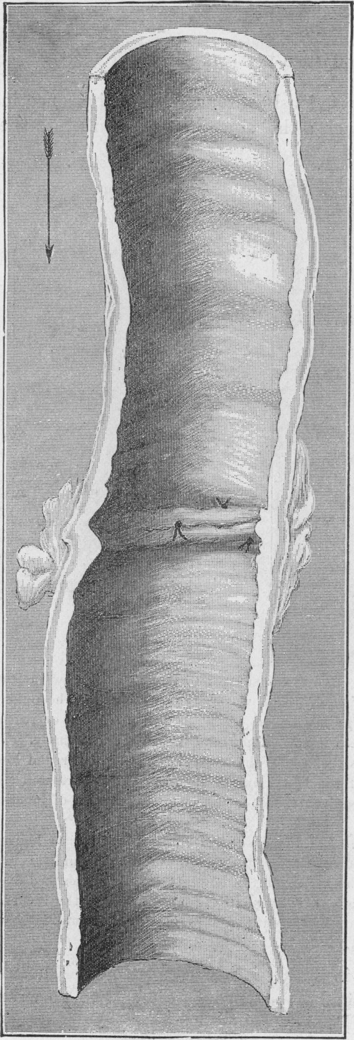 Fig. 11