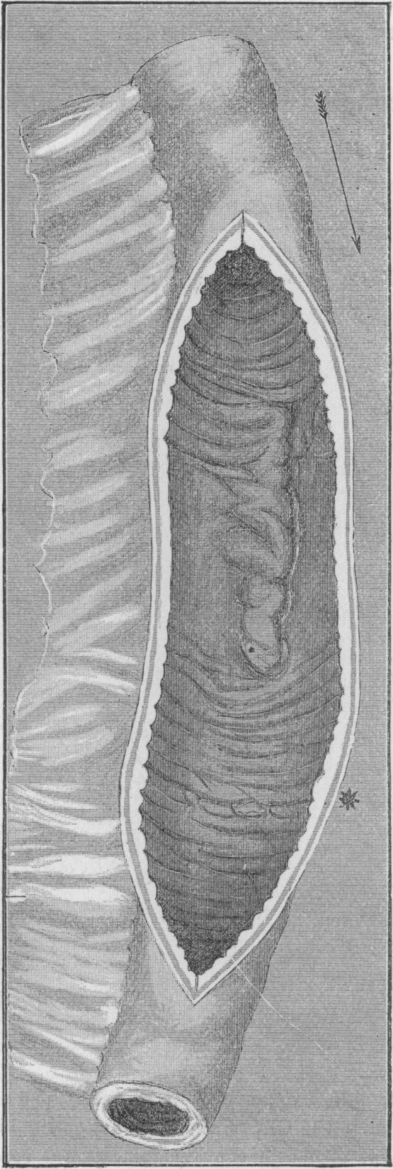 Fig. 14